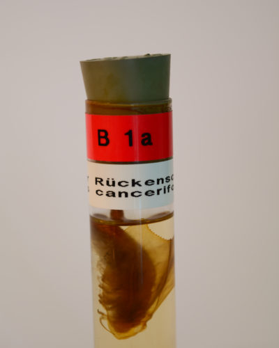 Großer Rückenschaler